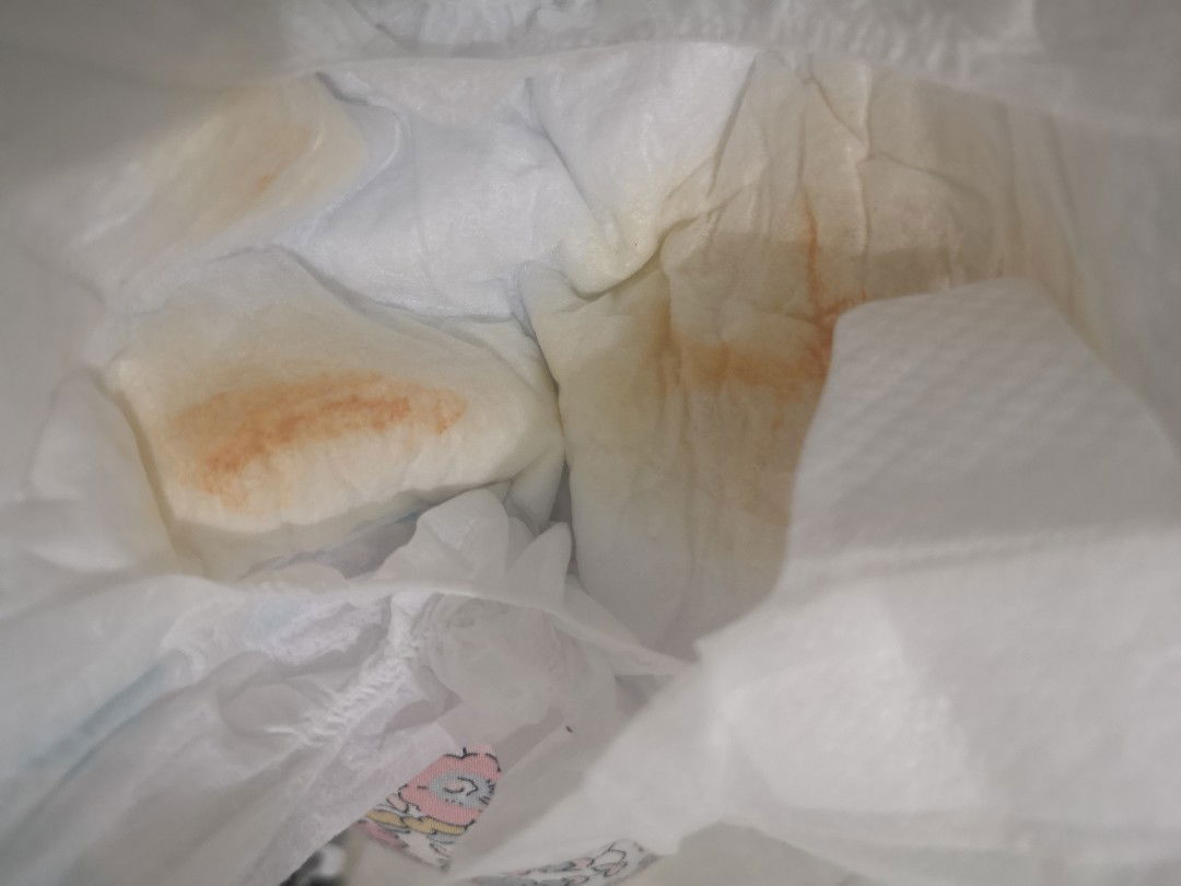 Pampers bayi 7 hari ada bercak kuning