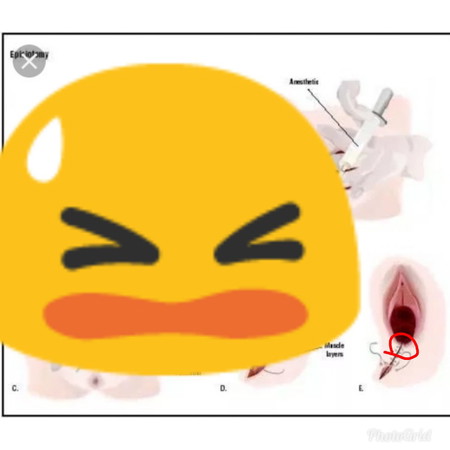 ??