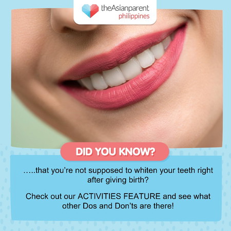 Do you whiten your teeth?