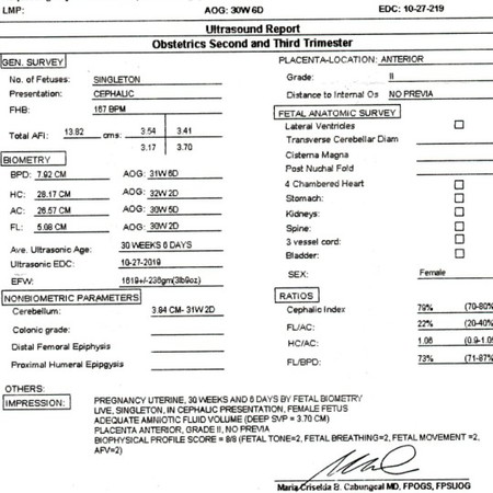 normal po ba result?