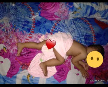 BB BAYI TIDAK BERTAMBAH