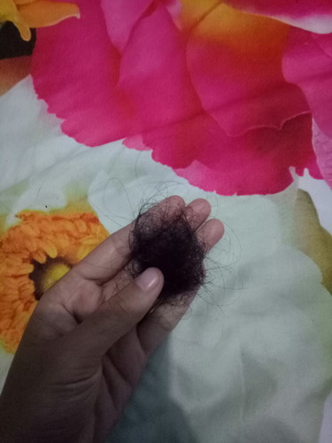 rambut rontok