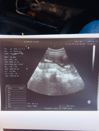 อยากทราบเพศค่ะ