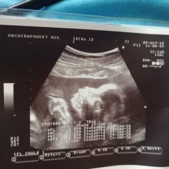 แม่ๆแต่ละบ้านซื้อของเตรียมตอนกี่เดือนคะ