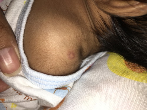 ปลูกฝีเด็ก