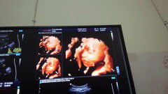 laki2 atau perempuan ?