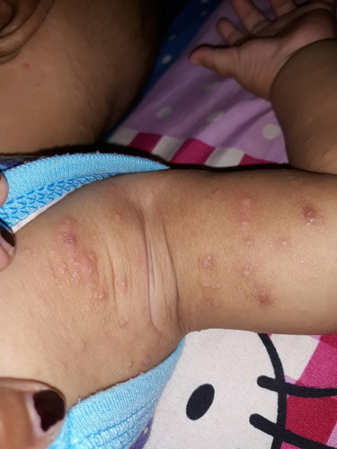 Biang keringet/ apa yah,,??