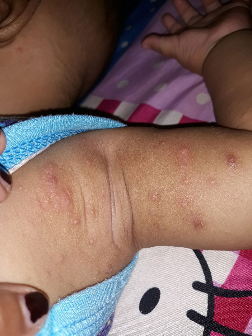 Biang keringet bkn??