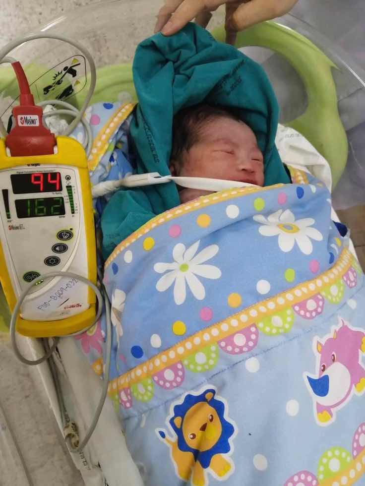 คลอดก่อนกำหนด