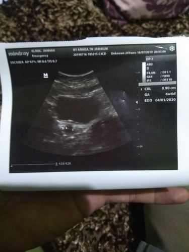 sakit tulang rusuk, dan hasil USG