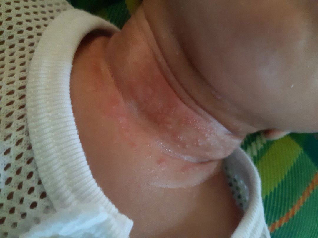 ubat apa yg perlu guna