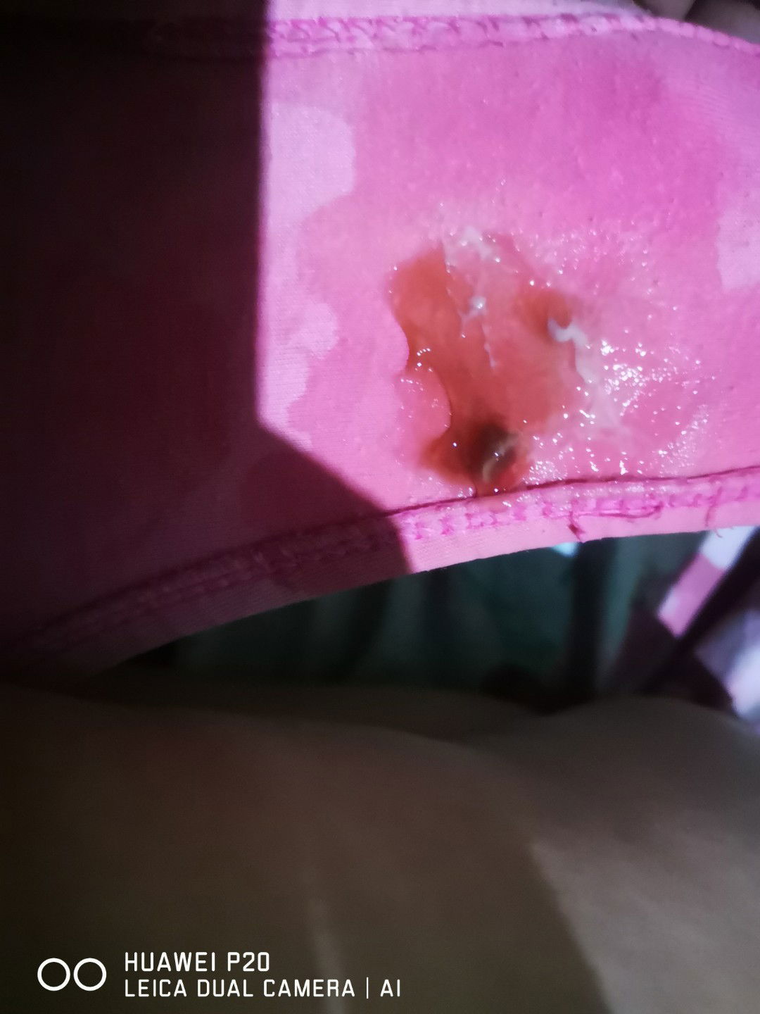 Punta na kaya ako ospital