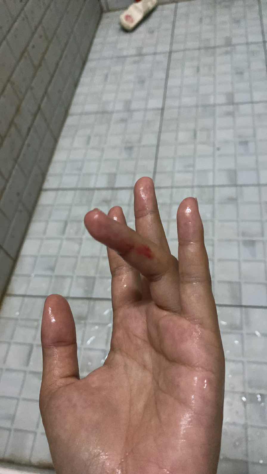 แบบนี้คืออะไรหรอคะ
32w3d