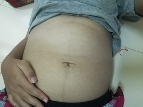 ขนาดท้อง