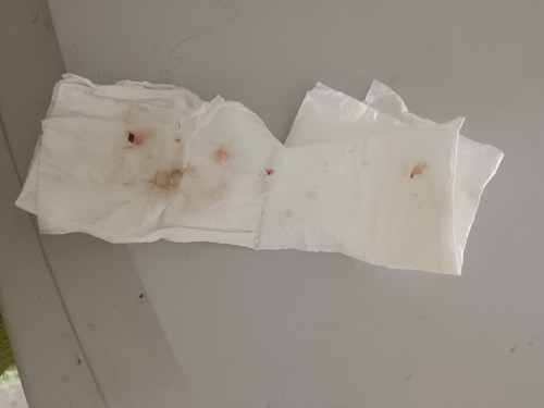 ตั้งครรภ์ 37+3 วีค ขอคำแนะนำหน่อยค่ะแม่ๆ