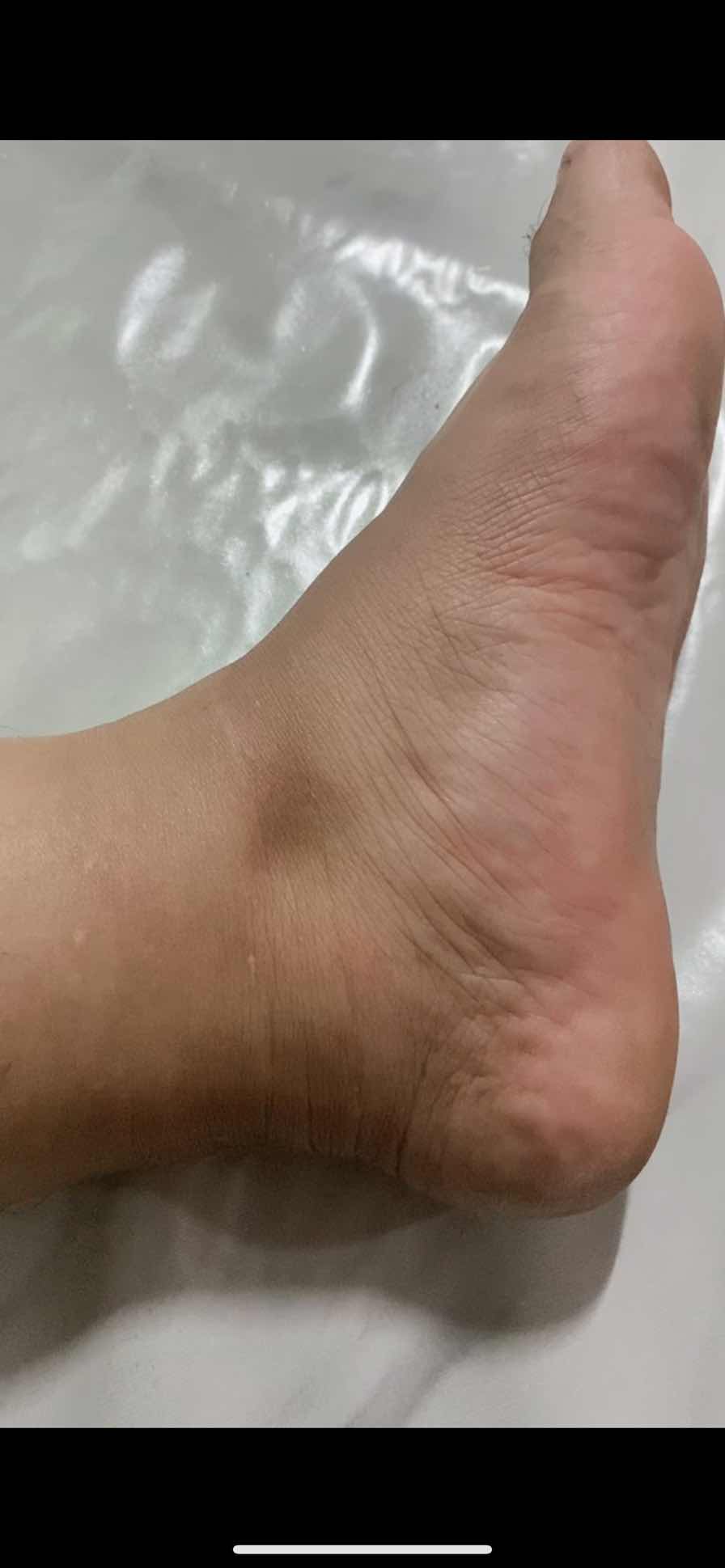 เเม่ตั้งครรภ์  ขอแชร์ประสบการณ์หน่อยค่ะ