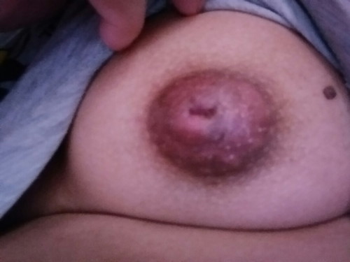 Inverted nipple