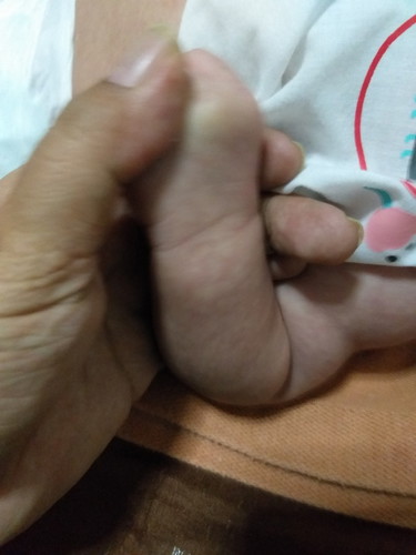 ลูกมีผิวลายๆมีคนบอกตัวจะกำลังจะขยายใหญ่  จริงหรือป่าวครับ?
