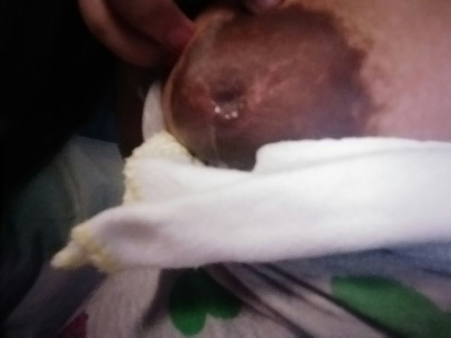 Paano po matigil or matuyo agad yung milk?