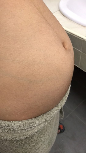 เด็กอ้วนของเเม่ 17สัปดาห์