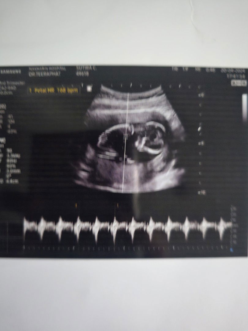 s.126 kaew profile icon