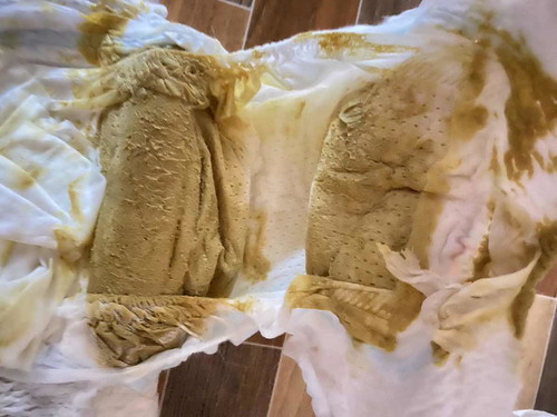 อึลูกเป็นแบบนี้ปกติไหมคะ