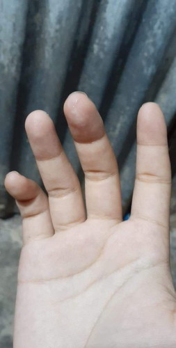 มีมูกขาวๆขุนๆๆ