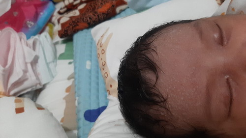 Bun anaknya pernah bruntusan begini nggk sih di jidat,