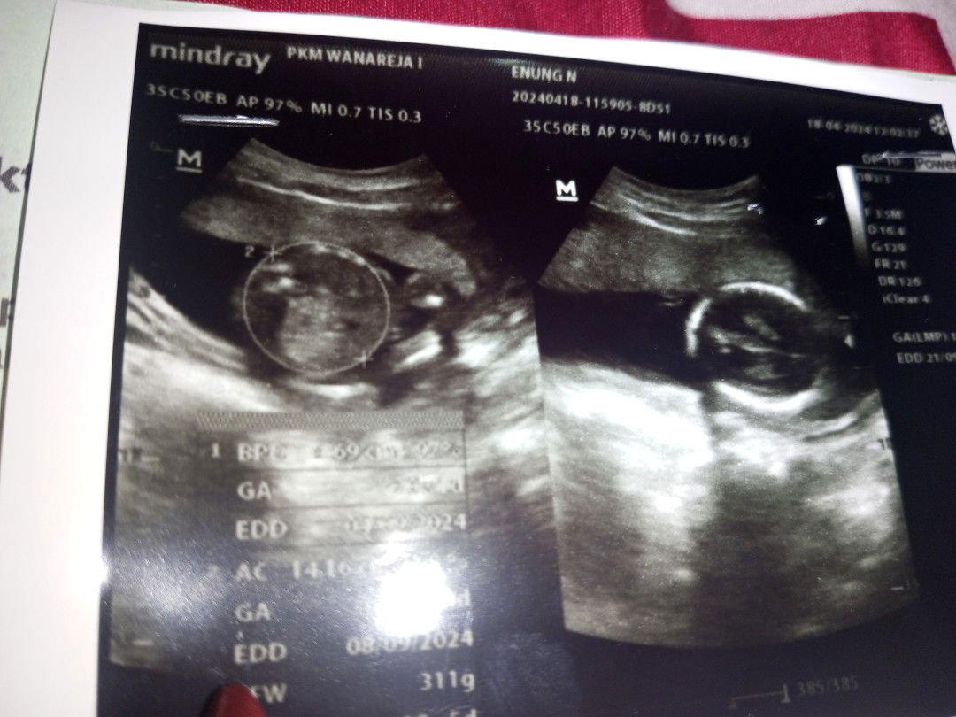 Nurhamidah profile icon