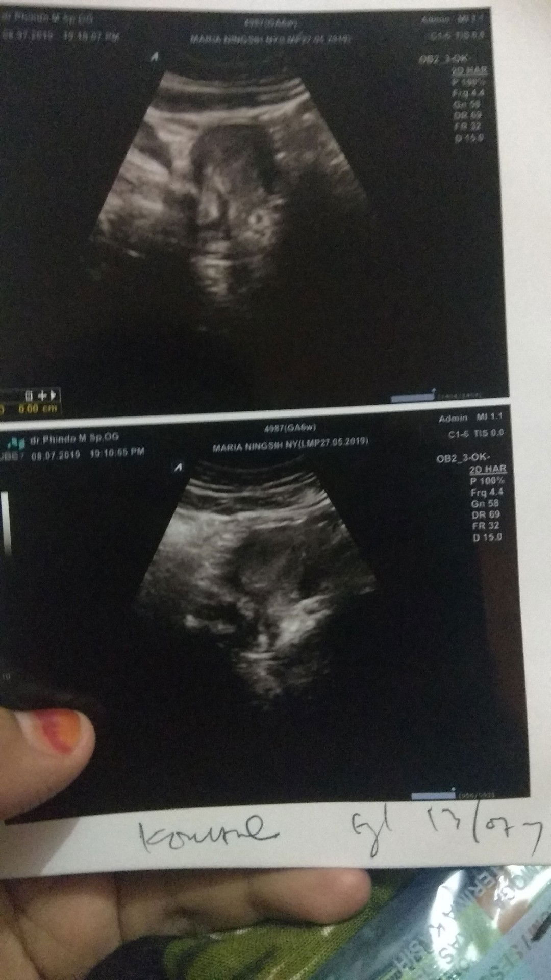 Umur kandungan 6 minggu 1 hari