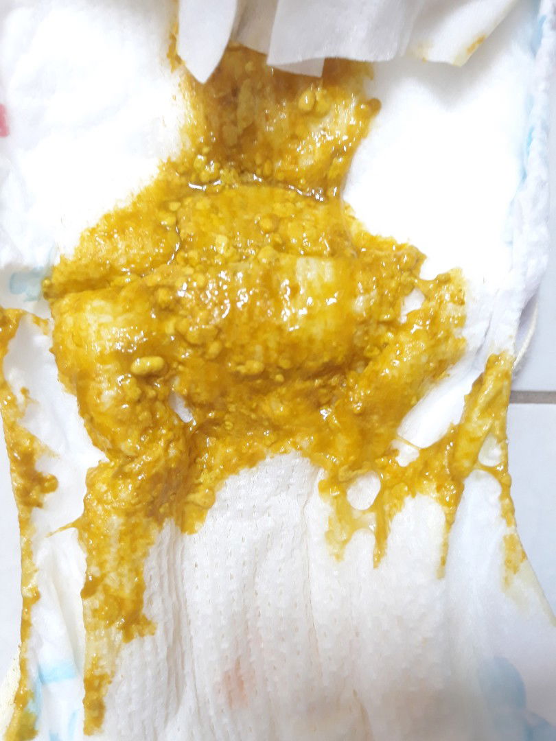 Con đi ị hằng ngày