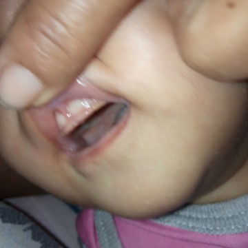 Baby tooth