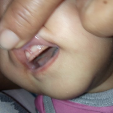 Baby tooth