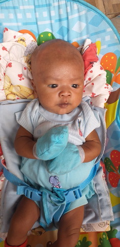 memperbaiki bentuk kepala