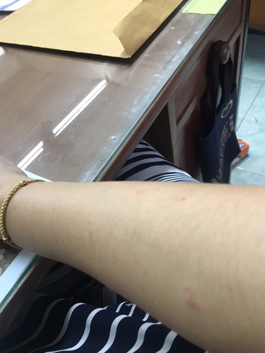 ท้อง 17 วีค