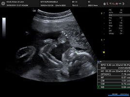 Bellaa Osw profile icon