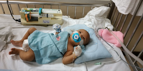 1เดือน17วันป่วย เป็นRSV