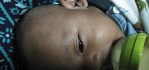 Kulit Muka Anak