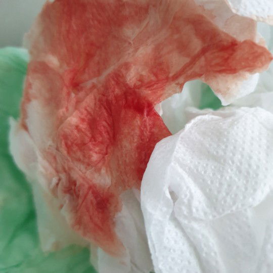 น้ำคาวปลาปกติมั้ยคะ