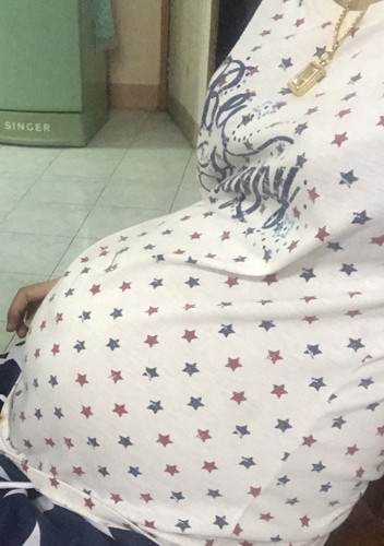ตั้งครรภ์ 31 wk 5 day ท้องเล็กไหมคะ