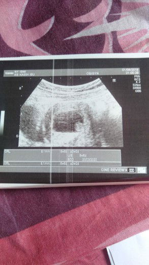 flek dan djj belum ada