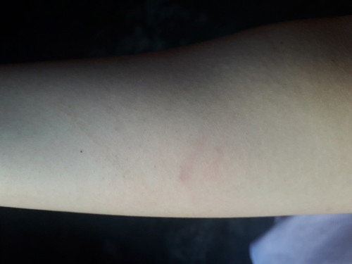play bite