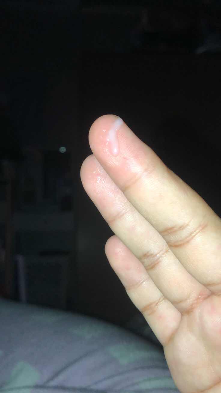 มูกไหลลักษณะเป็นยังไง