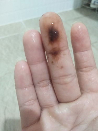 ตกขาวสีน้ำตาล