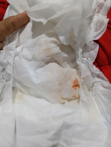 ฉี่น้องเป็นแบบนี้อันตรายไหมค่ะ