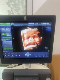 Yanisa Tibwongsa profile icon