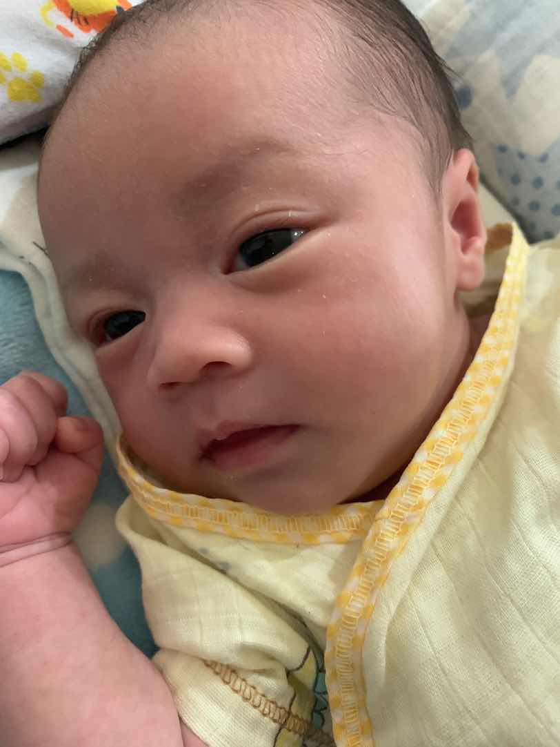 ขนคิ้วลูกร่วงเป็นเรื่องปกติหรือเปล่า