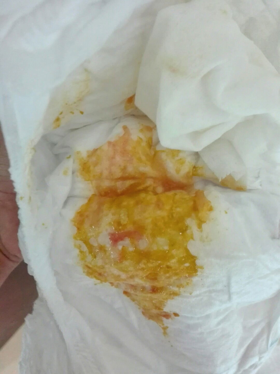 เเบบนี้ เรียกว่า อึปนมูกเลือดไหมคะ?