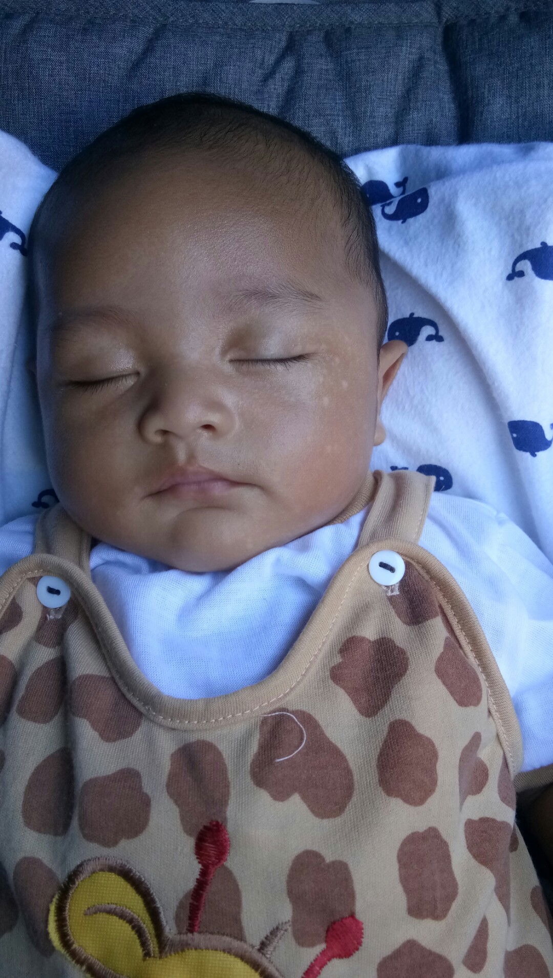 bercak putih pada wajah