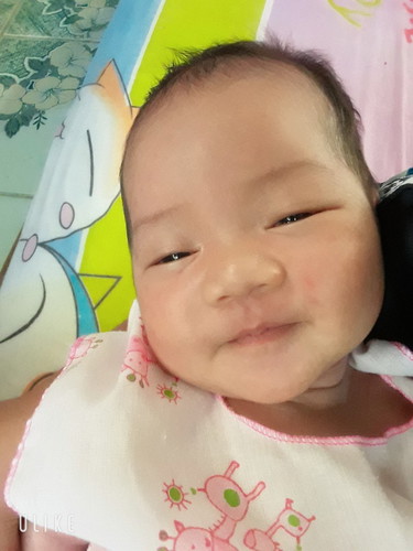 28วัน ไม่อยากให้หน้าเปลี่ยนเลย